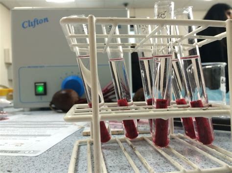 testing permeability of beetroot membrane|temperature effect on membrane permeability.